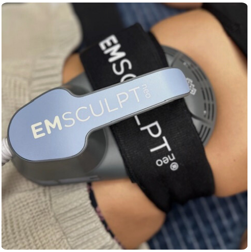 EMsculpt NEO before & after results: Is it worth it?