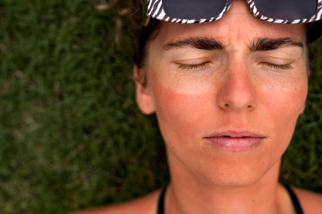 How Florida Sun Exposure Causes Long-Term Skin Damage