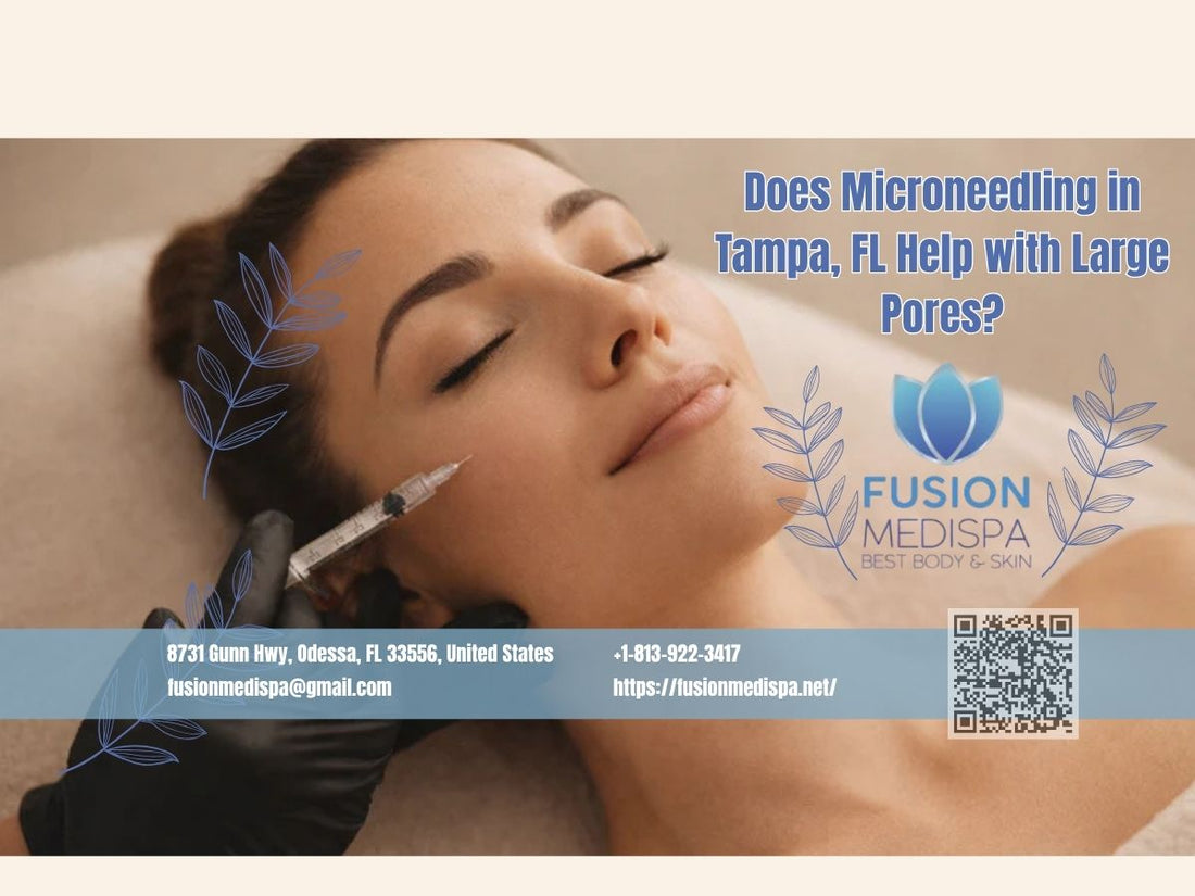 Does Microneedling in Tampa, FL Help with Large Pores?