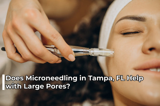 Does Microneedling in Tampa, FL Help with Large Pores?