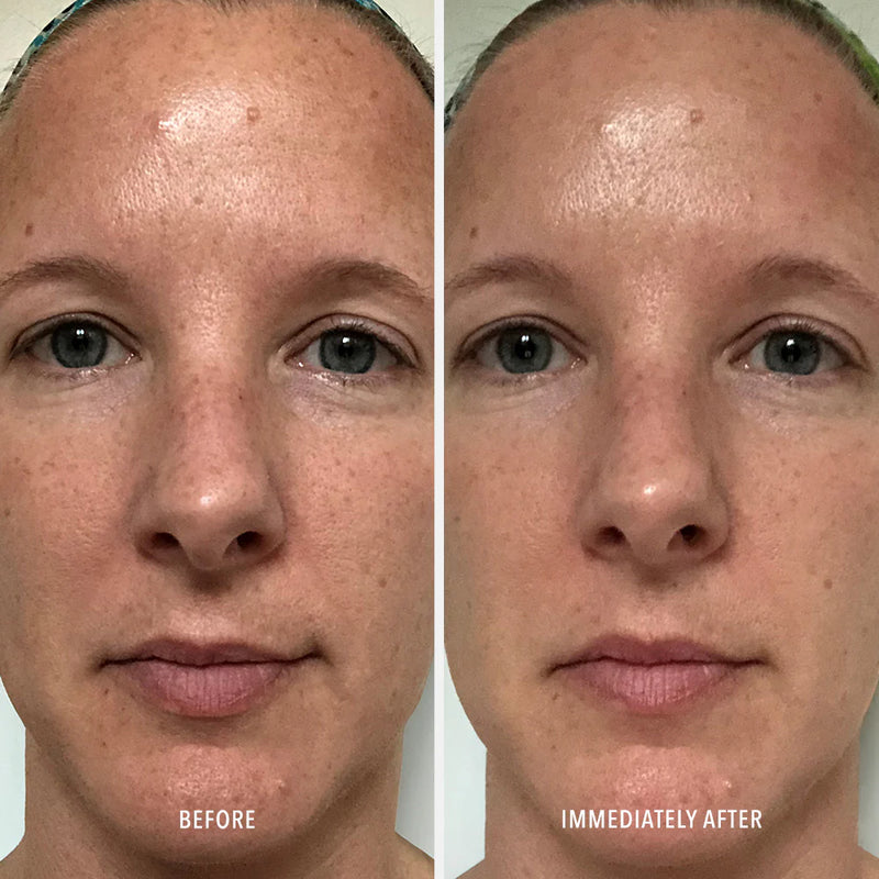 HydroPeptide® Polish & Plump Face Peel
