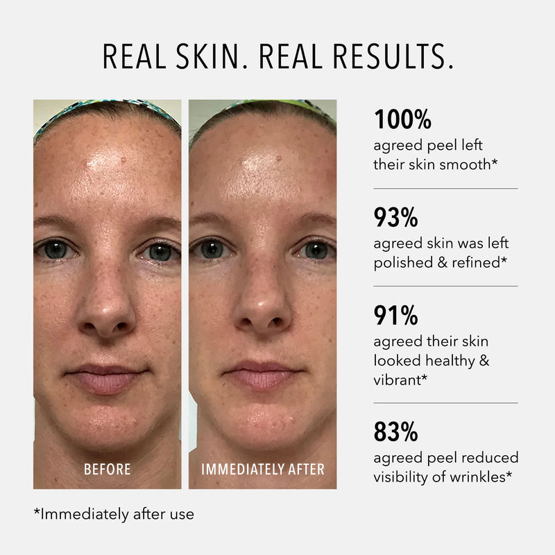 HydroPeptide® Polish & Plump Face Peel