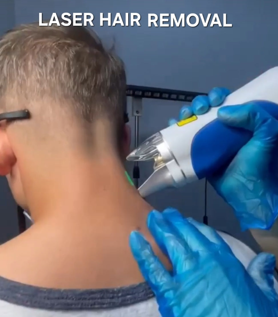 For the Guys! Laser hair removal Full back or chest get neck free