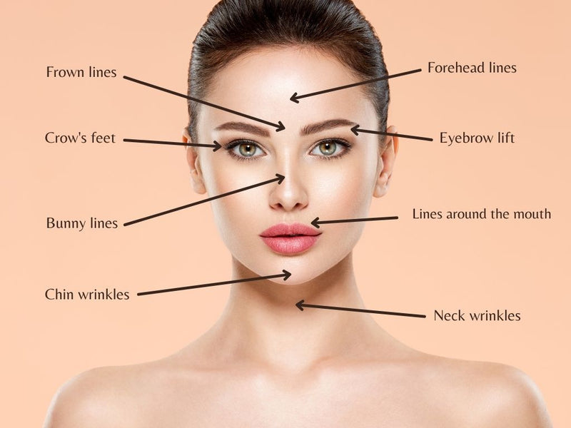 Botox, Jeuveau, Xeomin (Botulinum toxin)